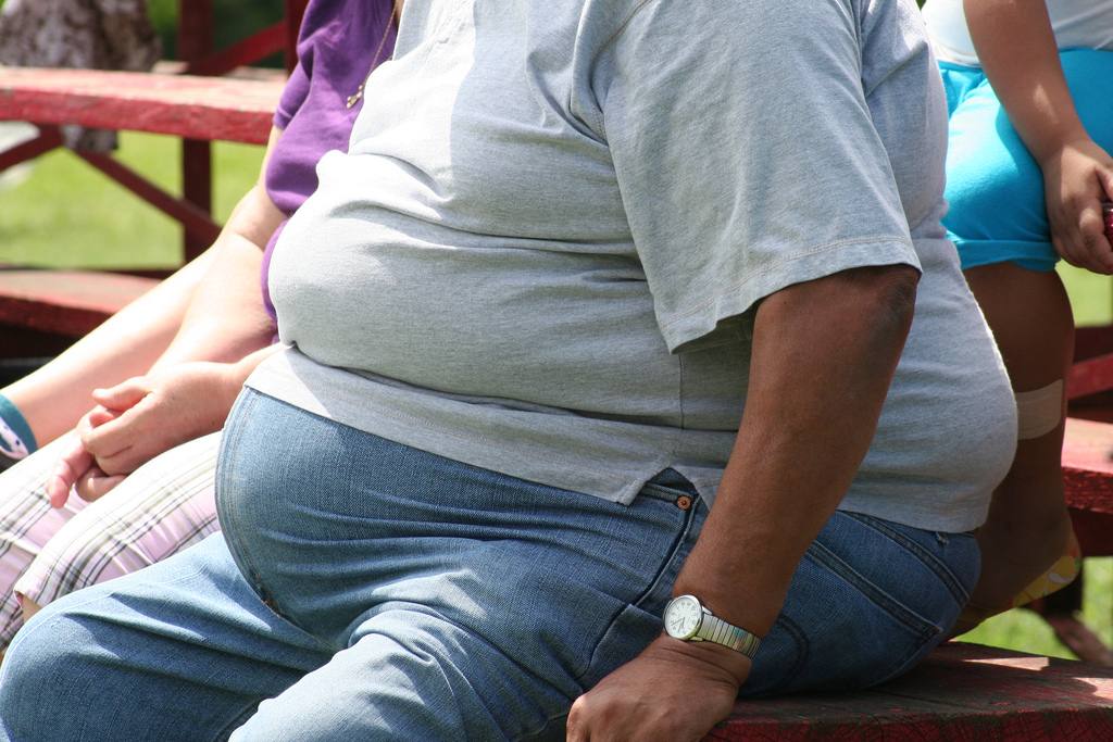 Comment sortir de l’obésité morbide