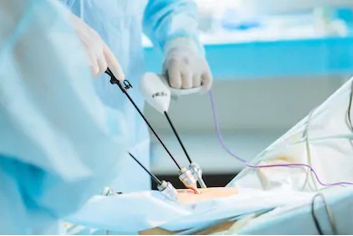 Qu\'est-ce que la chirurgie par cœlioscopie ?